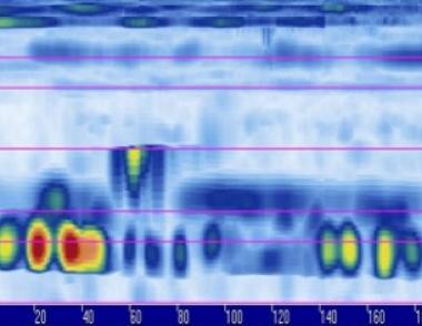 Ultrazvuková kontrola, PALM FLat skener