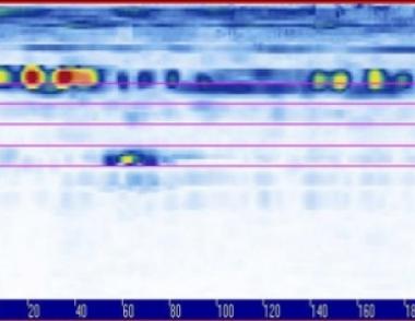 Ultrazvuková kontrola, PALM FLat skener